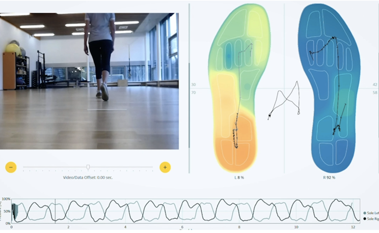 objective-visualization-of-gait-disorders-with-stapp-one